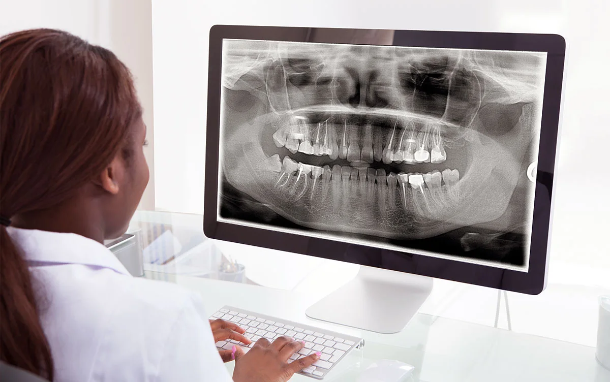 Une radiographie panoramique dentaire affichée à l’écran