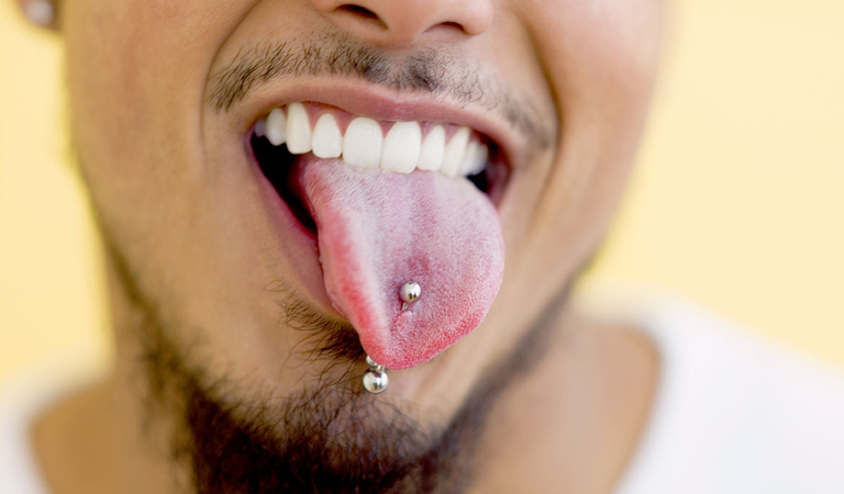 Bijoux dentaires et perçage buccal